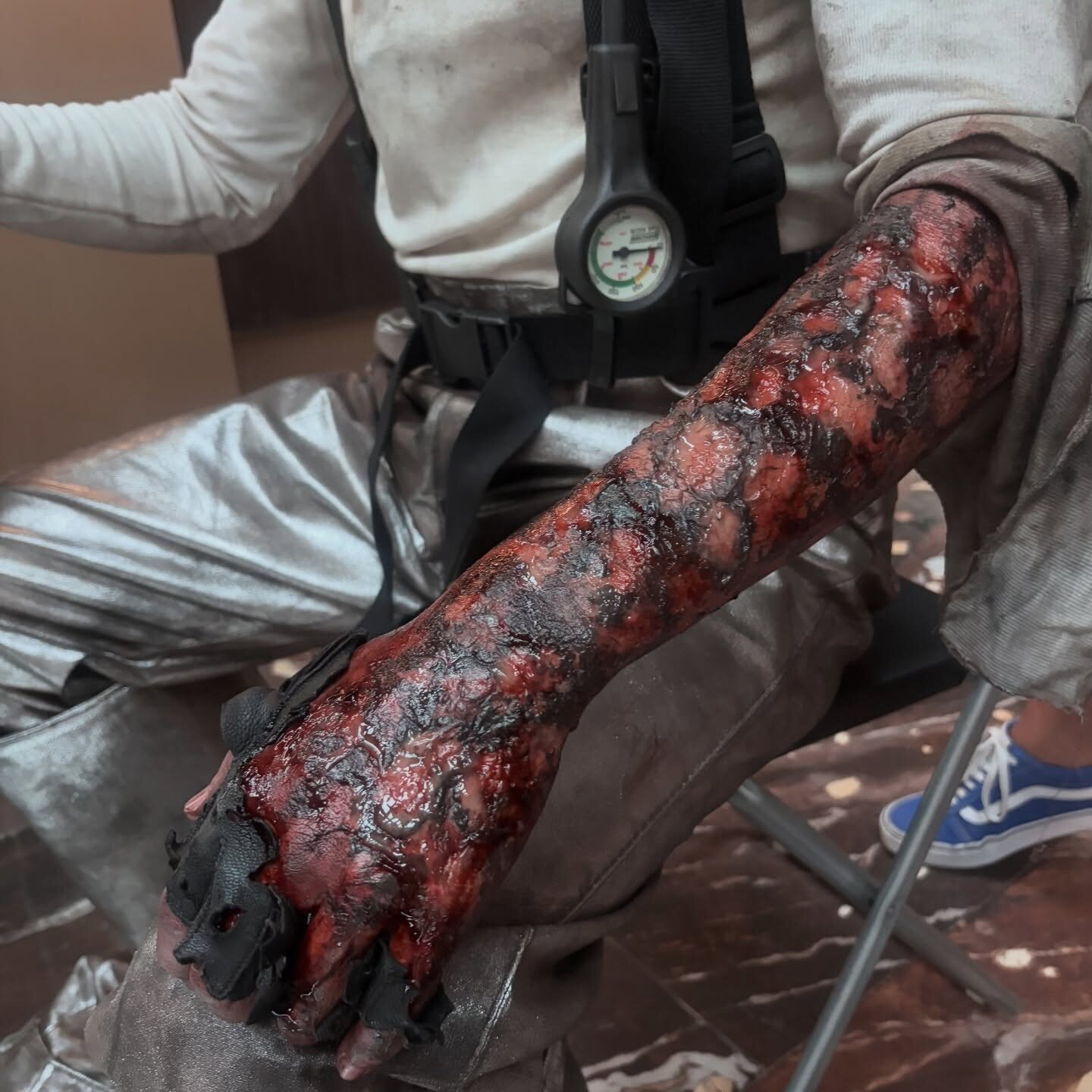 Prótesis de quemadura para Berlín y la dama del armiño