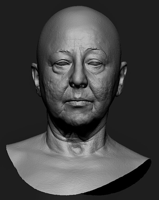 Escaneo facial digital en tres dimensiones